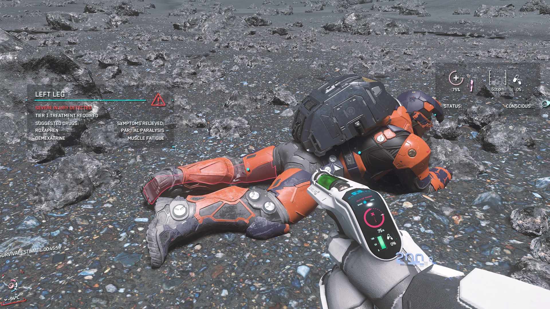 Tier 1 — Severe injury