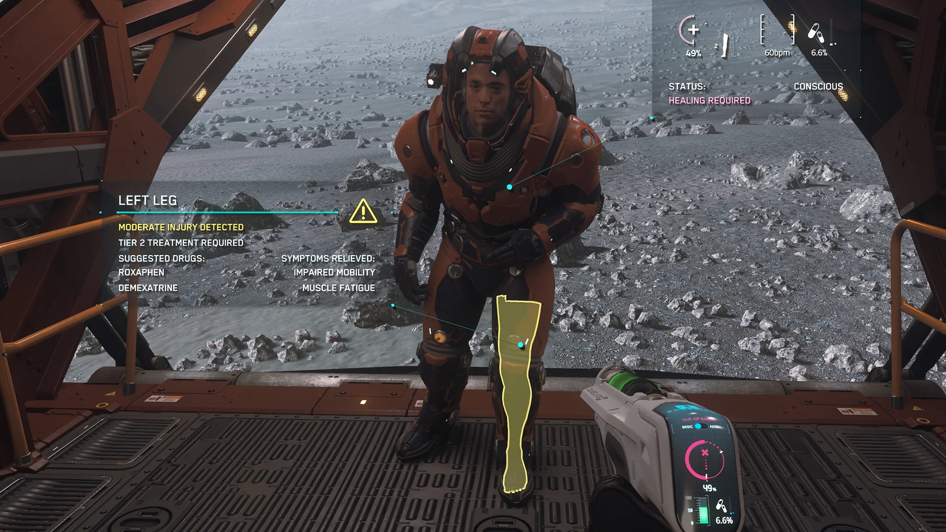 Tier 2 — Moderate injury